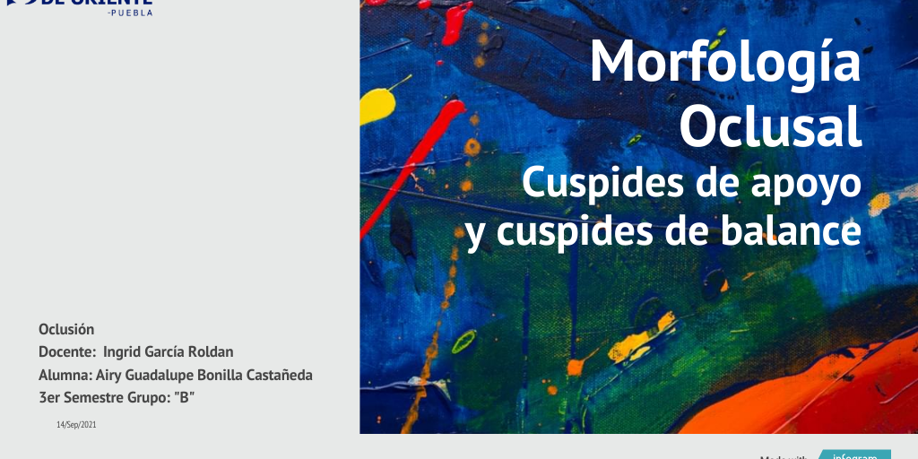 Cuspides de Apoyo y Balance Infogram