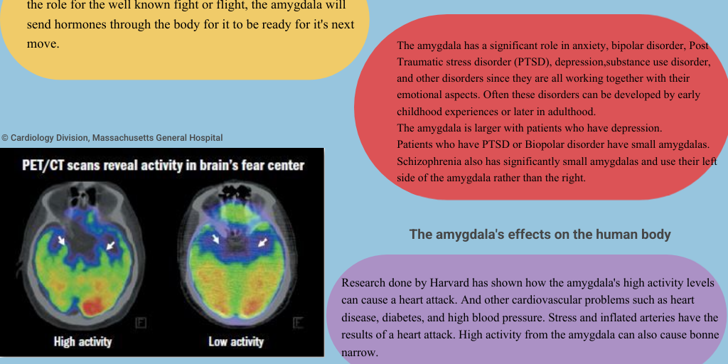 The Amygdala by Angel Torres - Infogram