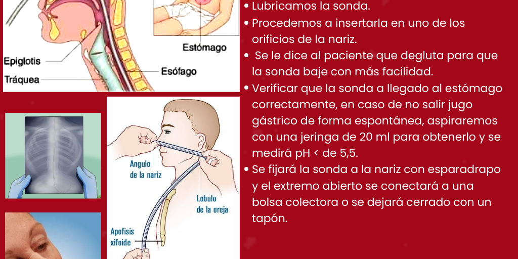 Como Hacer Una Maqueta De Sonda Nasogastrica infogram.com
