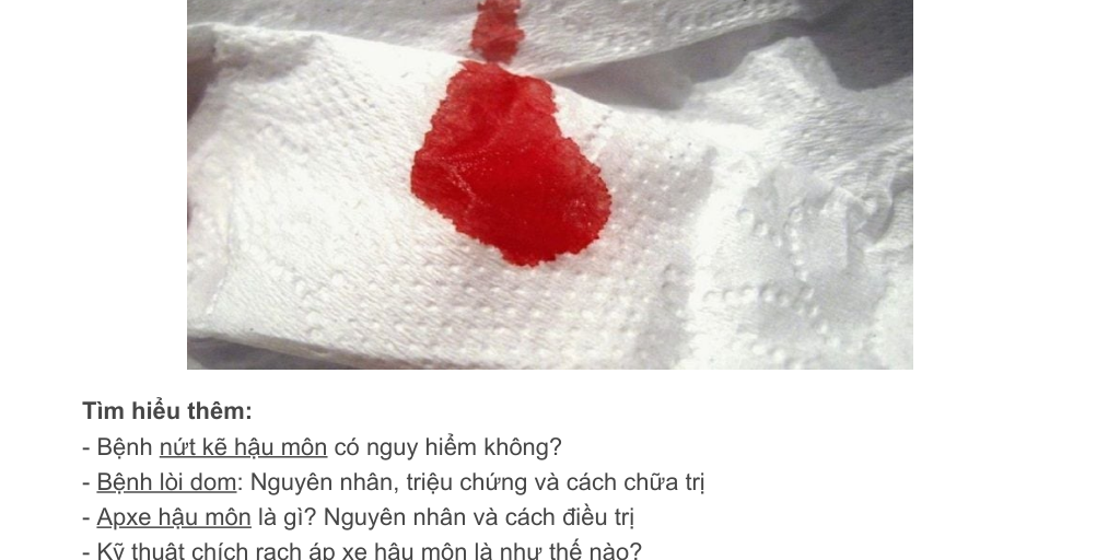 Đại tiện (đi ỉa, đi cầu, đi ngoài, vệ sinh) ra máu là bệnh gì? Cách ...